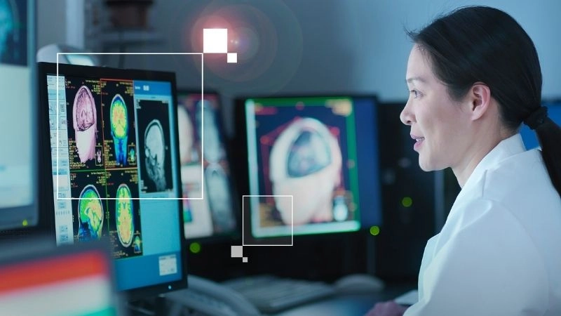 Xử lý hình ảnh