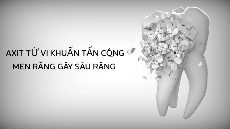 Axit từ vi khuẩn tấn công men răng gây sâu răng