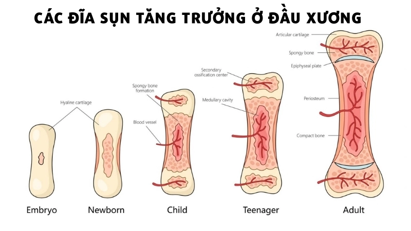 Các đĩa sụn tăng trưởng ở đầu xương quyết định sự phát triển chiều cao trước tuổi dậy thì