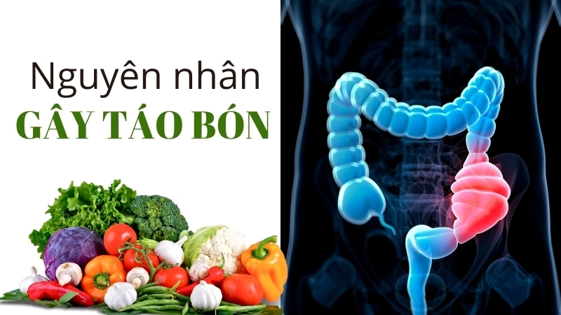 Chế độ dinh dưỡng thiếu chất xơ là nguyên nhân hàng đầu gây táo bón