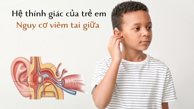  Hệ thính giác của trẻ em và nguy cơ viêm tai giữa