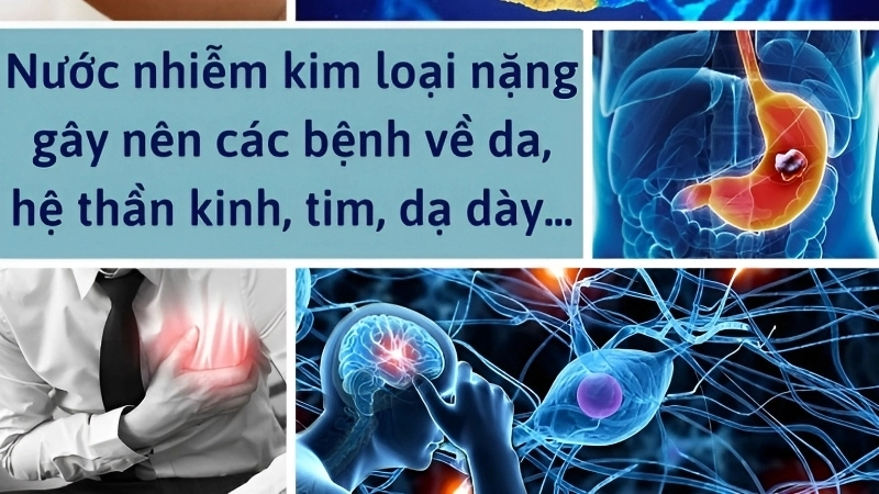 Hậu quả của kim loại nặng đối với môi trường và sức khỏe