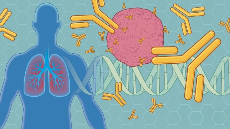  Liệu pháp miễn dịch trong điều trị ung thư phổi giai đoạn cuối