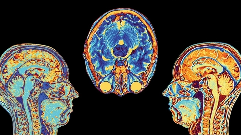 Não bộ là trung tâm điều khiển mọi cảm xúc của con người