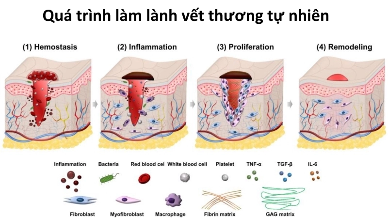  Quá trình làm lành vết thương tự nhiên của sinh học cơ thể
