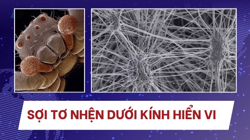  Sợi tơ nhện dưới kính hiển vi, hé lộ cấu trúc sinh học động vật độc đáo