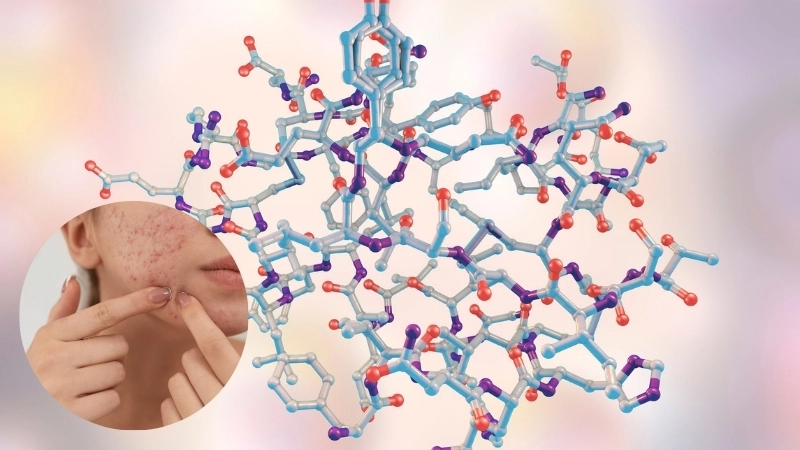  Sự thay đổi hormone là một yếu tố sinh học cơ thể quan trọng ảnh hưởng đến mụn