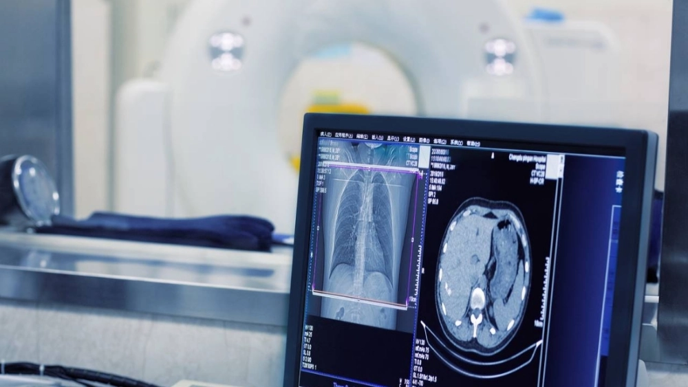  Trí tuệ nhân tạo trong y tế xác định khối u từ ảnh chụp MRI