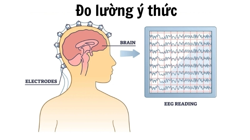  Hình ảnh sóng não thu được từ máy điện não đồ (EEG) khi đo lường ý thức