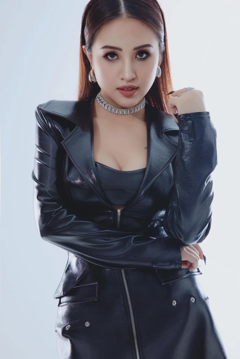 Vân Hugo bị bệnh gì cô mắc bệnh nhược thị bẩm sinh và các vấn đề sức khỏe